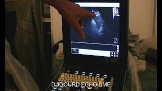 Demonstration echographe eco 3