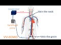 what is ecmo intro