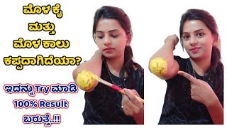 ಮೊಳ ಕೈ ಮತ್ತು ಮೊಳ ಕಾಲು ಬೆಳ್ಳಗಾಗಲು ಹೀಗೆ ಮಾಡಿ Home Remedy for Elbow and Knee whitening in Kannada Vlogs