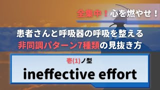 人工呼吸器の非同調【ineffective effort】解説レクチャー