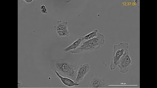 HeLa Cells time lapse