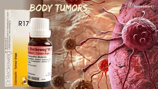 Shrink Tumors Naturally: Unveiling Dr. Reckeweg's R17 Homeopathy Drops!