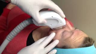 INSTANT LASER CLINIC _Endy Med Fractional Skin Resurfacing Demonstration_Part 2