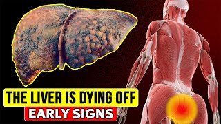 14 early signs that your LIVER IS DYING. People with liver problems don't even know it...