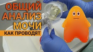 Как выполняется общий анализ мочи в лаборатории.