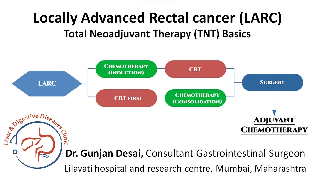 Locally Advanced Rectal Cancer & Total Neoadjuvant Therapy - Induction ...