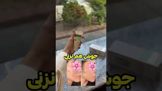 کرم ضدلک و آکنه گاتیو