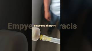 #empyemathoracis#empyema EMPYEMA THORACIS