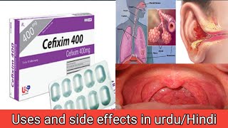 cefixime tablet uses in urdu/cefixime capsules 400 mg