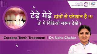 टेढ़े मेढ़े दांतों से परेशान है !!! तो ये विडिओ जरूर देखे ? Crooked Teeth Treatment । Dr. Neha Chahar