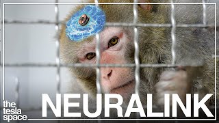 Is There A Dark Side To Neuralink..