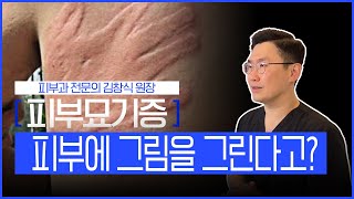 조그만한 자극에도 간지럽고 붓는 피부 질환, 피부묘기증ㅣ원인, 예방법, 치료법ㅣ