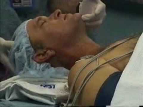 Intubation Youtube