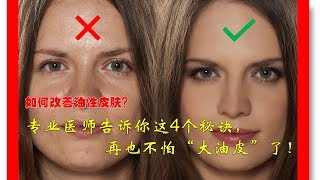 如何改善油性皮肤？专业医师告诉你这4个秘诀，再也不怕“大油皮”了！