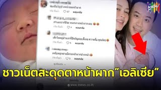 ชาวเน็ตตาดี สะดุดตาหน้าผาก “น้องเอลิเซีย” ทายาท “แพทริเซีย-โน้ต” หลังคลอด