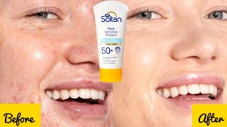 Soltan face sensitive protect sunscreen cream | Which sunblock is good for you ? Best for anti aging