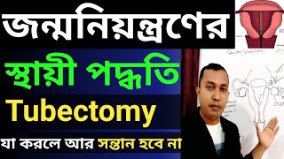 যা করলে কখনো সন্তান হবে না | Tubectomy in Bengali | জন্ম নিয়ন্ত্রণের স্থায়ী পদ্ধতি | Tubectomy|