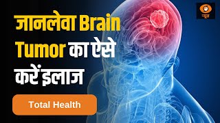 जानिए कैसे जानलेवा Brain Tumor का करें इलाज | Brain Cancer | Total Health