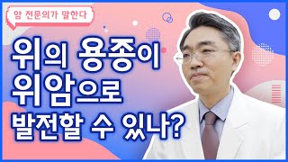 Q. 위에 용종이 있다는데, 위암으로 발전할 수도 있나요? [위암 편]