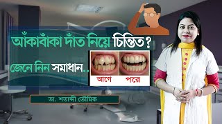 আঁকাবাঁকা দাঁত নিয়ে চিন্তিত?  || জেনে নিন সমাধান || Dr. Shatabdi Bhowmik