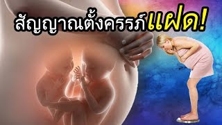 ท้องลูกแฝด : สัญญาณตั้งครรภ์แฝด | ความเชื่อคนท้อง | คนท้อง Everything