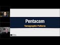 dr. beeran meghpara treating fuchs dystrophy and cataracts with the oculus pentacam®