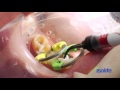 isolite the best isolation system for dental posterior composites