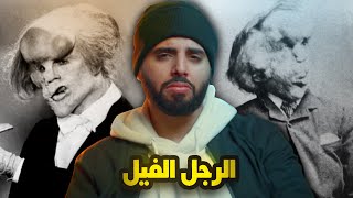 رمته زوجة أبيه في الشارع ليموت! ولكنه عاد ليتحدى الجميع!