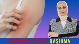 Quru dəri, Dərman allergiyası, Böcək dişləməsi.../ QAŞINMANIN səbəbləri