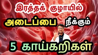 மாரடைப்பை தடுக்கும் 5 காய்கறிகள் இதோ! | Eat 5 Vegetables to prevent Heart-Attack | Dr.Pillai |TAMIL