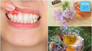 5 Natural Home Remedies for Gingivitis - Australia 365