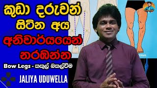 Bow Legs Sinhala | Genu Varum Treatment in Sri Lanka | Baby care | Rickets |   Physiotherapy Tips