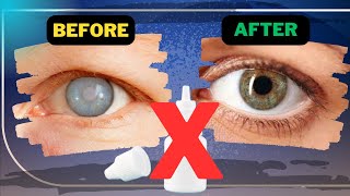 VISION BOOST! 8 Herbs to Heal Eyesight and Protect Eyes