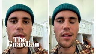Justin Bieber cancels shows after half of face left paralysed by virus