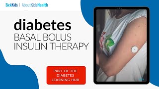 Basal Bolus Insulin Therapy for Children with Diabetes | AboutKidsHealth at SickKids