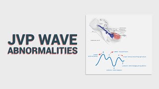 Abnormal JVP waves - Quick Overview