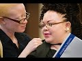 iaad2021 centre for human rights celebrates international albinism awareness day