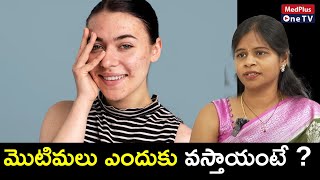 మొటిమలు ఎందుకు వస్తాయి ? How to get Rid of Pimples | Dr.Swapna Priya @MedPlusONETV