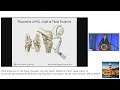 Diagnosis and Treatment of PCL & Posterolateral Ligament injuries : Dr Frank Noyes