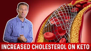 Keto And Cholesterol: Why LDL Can Increase on Low Carb Diet – Dr. Berg