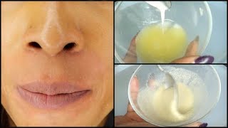 CLEAR DARK AREAS AROUND THE MOUTH NATURALLY AT HOME |Khichi Beauty