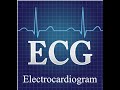 How to read ECG | Full Crash Course | Minisy Teaches