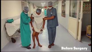 जयपुर में घुटने बदलने (knee replacement surgery) का जटिल ऑपरेशन किया | डॉ. विवेक शर्मा  #tkrsurgery