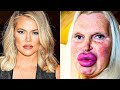 20 Celebrity Plastic Surgery Disasters