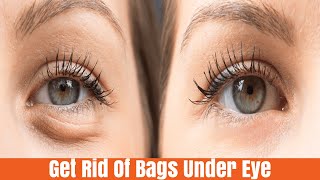 8mins Anti-Aging Eye Lifting Massage For Dark Circles Under Eye Bags, Bigger Eyes and eye sagging