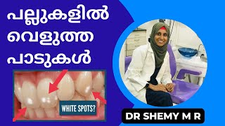 WHITE STAIN (Spots) on teeth (2023)|| പല്ലുകളിൽ വെളുത്ത പാടുകൾ|| Reasons and Remedies|| Dr SHEMY M R