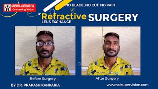 -28 number Refractive Lens Exchange Surgery at Sai Surya Netra Seva