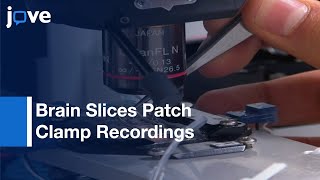 Brain Slices Whole Cell Patch Clamp Recordings