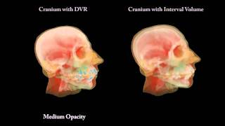 Direct Interval Volume Visualization