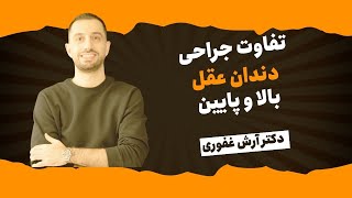 تفاوت جراحی دندان عقل بالا و پایین [ دکتر آرش غفوری ]